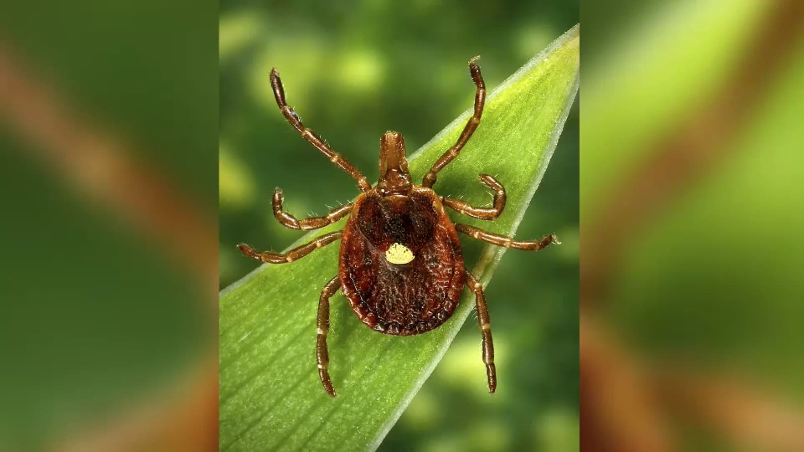 New Jersey man is 1st confirmed death linked to a meat allergy spread by ticks