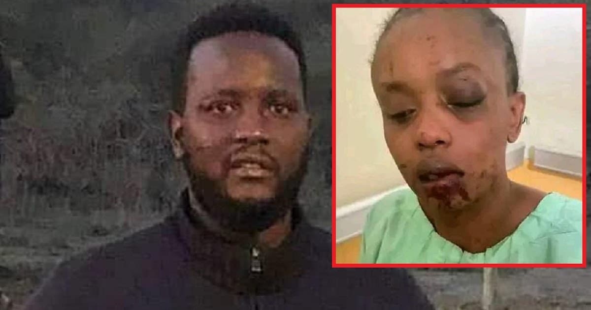 Uproar as the son of former Inspector General of Police, HILLARY MUTYAMBAI, viciously attacks his cousin, LULU KYALO, and leaves her with a disfigured face (PHOTOs)